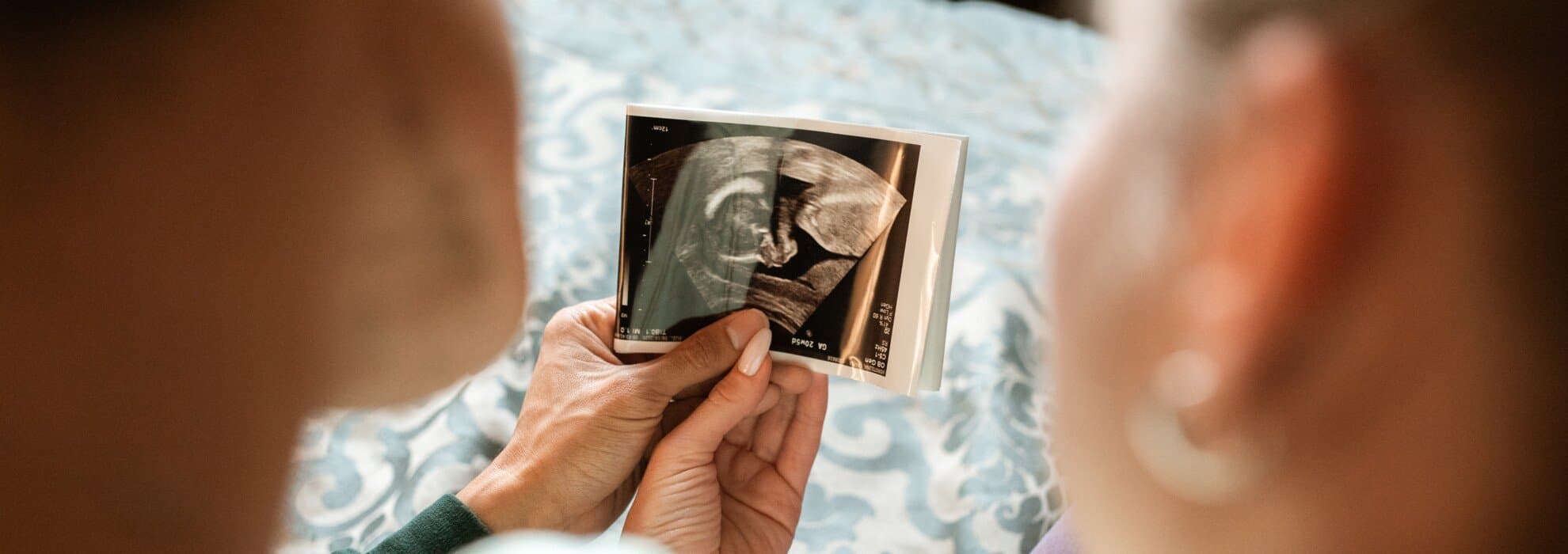 kvinna tittar på ultraljud kvinna tittar på ultraljud